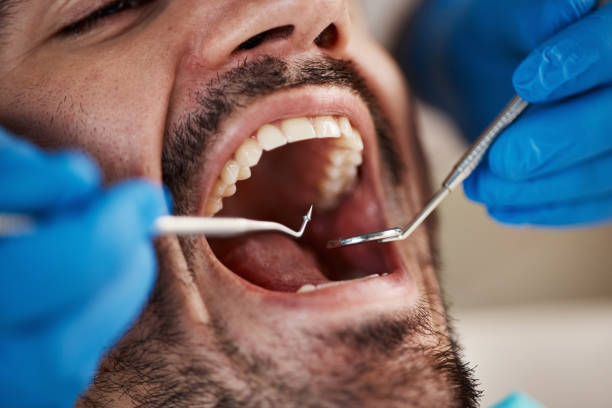 Best Pediatric Emergency Dentist in Rural Hall, NC