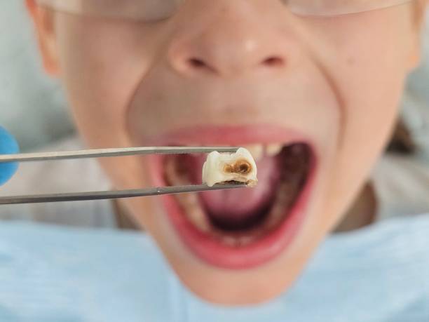 Best Emergency Gum Treatment in Rural Hall, NC
