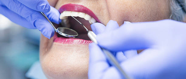 Best Emergency Wisdom Teeth Removal in Rural Hall, NC