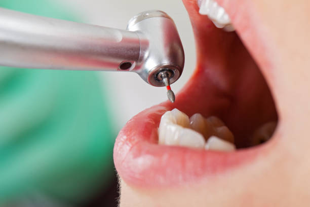 Best Emergency Dental Care for Broken or Chipped Teeth in Rural Hall, NC